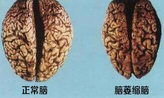 幸运8V8.5专业版